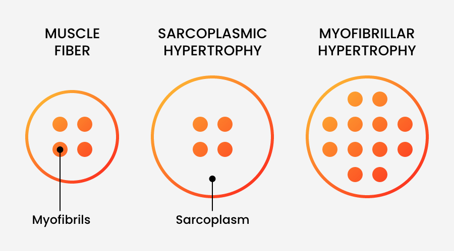 different types of hypertrophy infographic