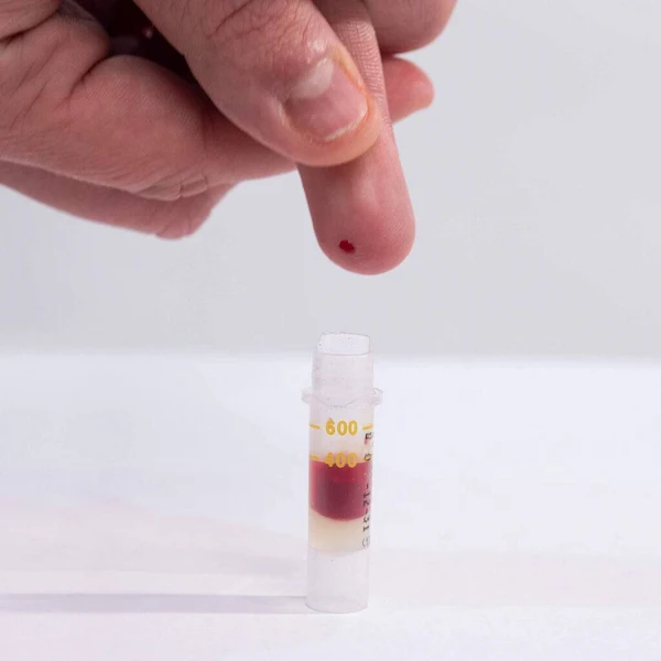 Blood dropping from a hand into a yellow tube